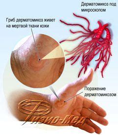 Паразиты и инфекции: