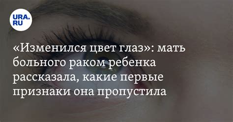 Первые признаки изменения цвета глаз