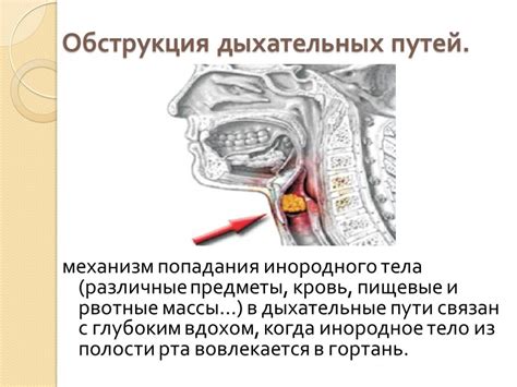 Повреждение дыхательных путей