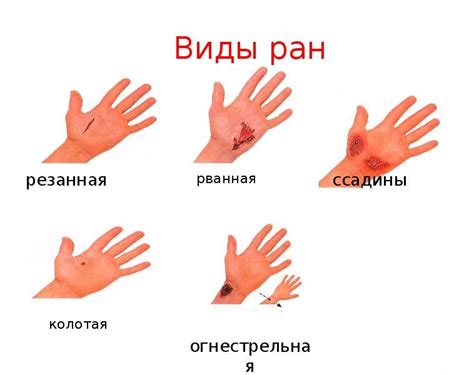 Повреждения кожи