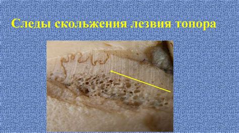Повреждения от острых предметов