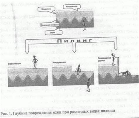 Повышенное стрессовое воздействие