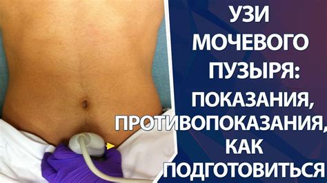 Показания и противопоказания при парении ног при воспалении мочевого пузыря