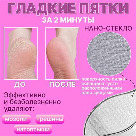 Полезные свойства мази с йодом для пяток