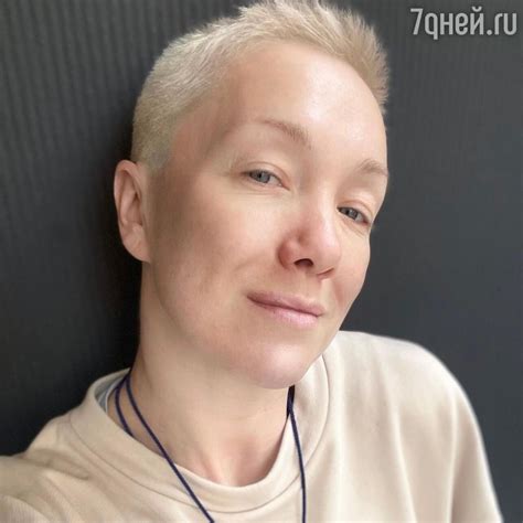 Популярность и влияние шрама на карьеру Дарьи Мороз