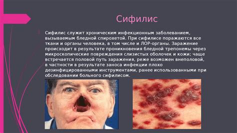 Последствия сифилиса для трудовой деятельности