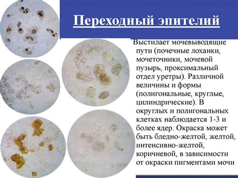 Потенциальные риски при изменении окраски мочи