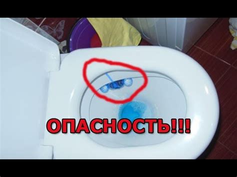 Почему длительное время проведенное на унитазе может привести к проблемам с мочеполовой системой