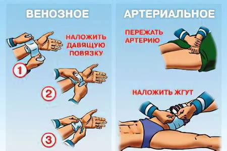 Правила первой помощи при кровотечении после прокола мочки уха