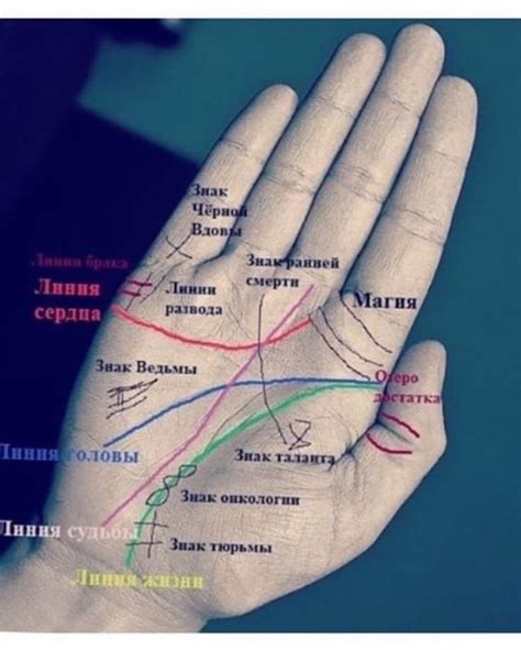 Преимущества использования резинок на правой руке