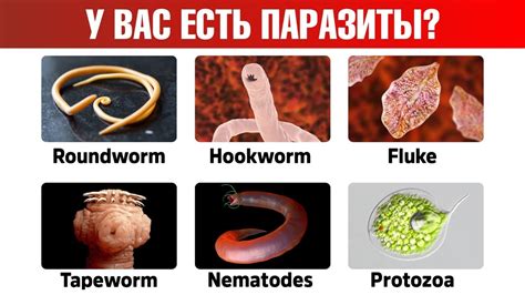 Признаки глистов на белье
