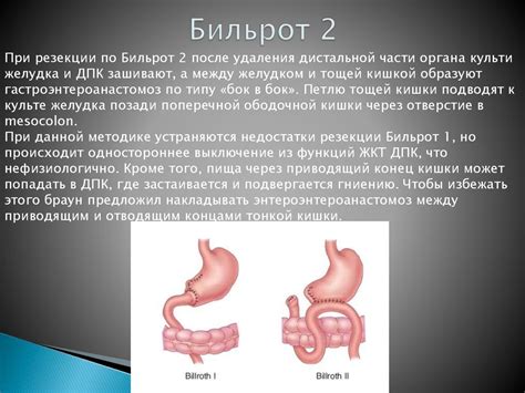Причина #1: Уменьшение объема желудка