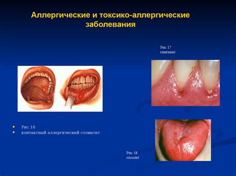 Причина 3: Раздражение слизистой оболочки