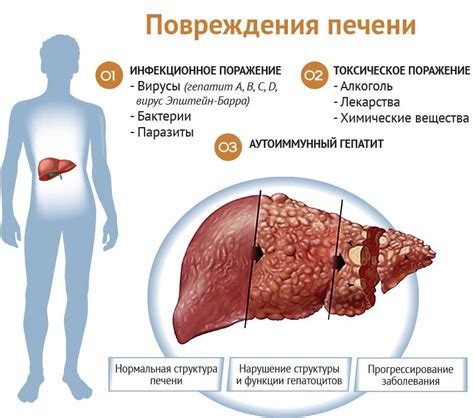 Причина 3: заболевания печени