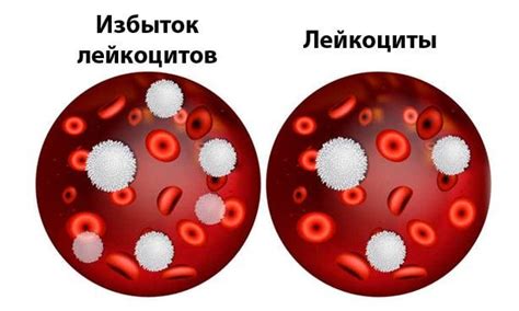 Причины кражи иммуноглобулина медсестрой