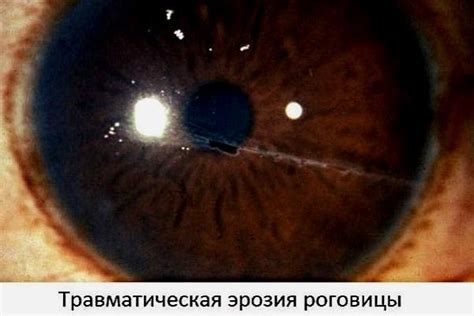 Причины мутности горного хрусталя в кольцах