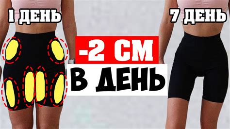 Причины просвета между бедрами