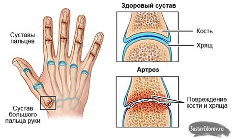 Причины увеличения объема пальцев рук в возрасте