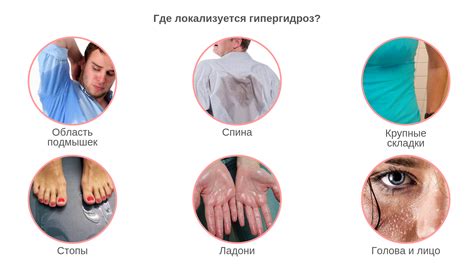 Причины физиологического потоотделения