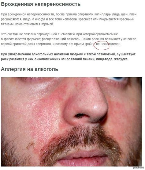 Причины этого феномена, объяснены специалистами