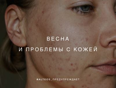 Проблемы с кожей при контакте с гипсом
