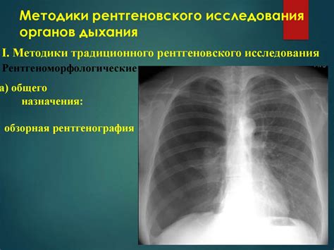 Проведение рентгеновского исследования