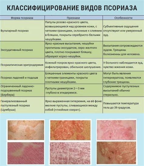 Псориаз и другие кожные заболевания