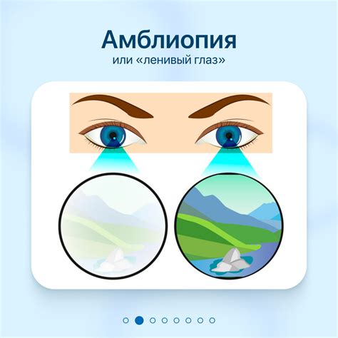 Синдром ленивого муравья