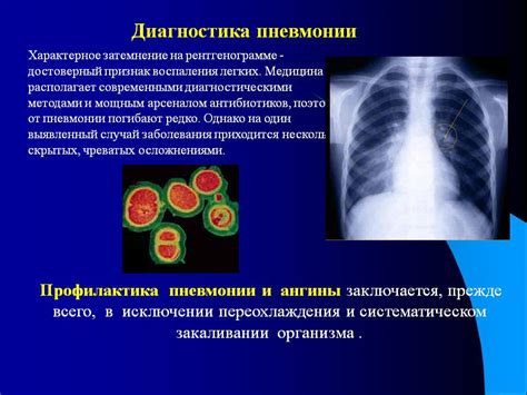 Снижение воспаления легких с помощью шоколада
