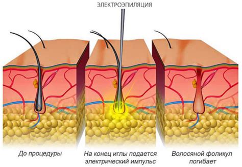 Художественное значение лобковых волос