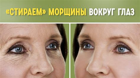 Частые ошибки при точке гусиных лапок
