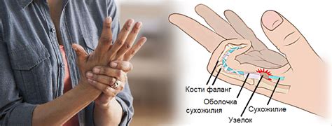 Эндорфиновый ответ: почему палец начинает гореть